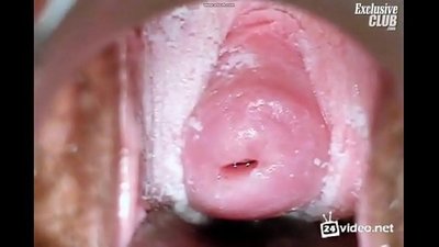 Gynecological examen pulchrae feminae